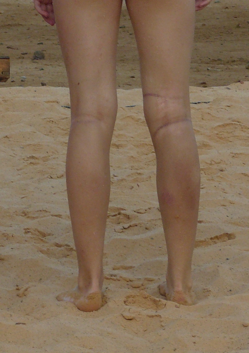 nogi